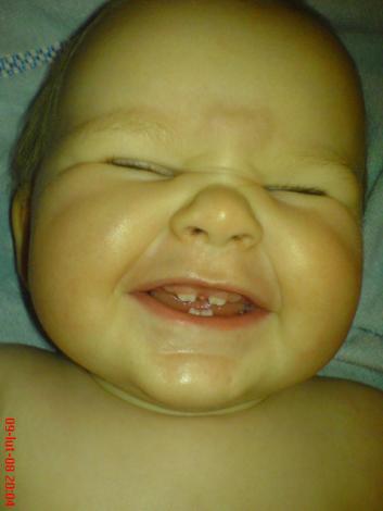 Pierwsze ząbki<a href="profile.php?lookup=89"> - emila</a><br/>
		         Komentarzy: 4
 Obejrzano:  40010 Ocena: <img src="images/star.gif" alt="*" style="vertical-align:middle"/><img src="images/star.gif" alt="*" style="vertical-align:middle"/><img src="images/star.gif" alt="*" style="vertical-align:middle"/><img src="images/star.gif" alt="*" style="vertical-align:middle"/><img src="images/star.gif" alt="*" style="vertical-align:middle"/>
